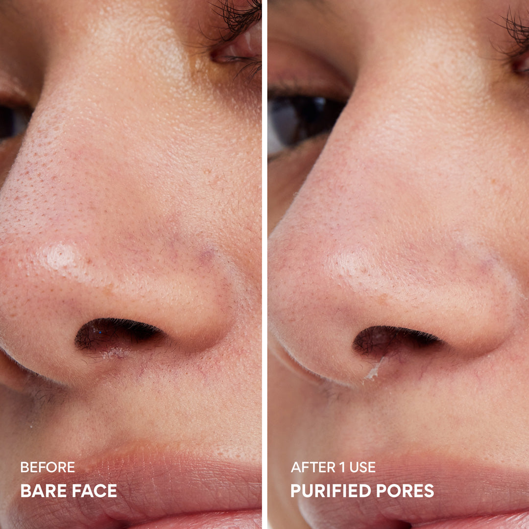 [INNISFREE] Super Volcanic Pore Clay Mask 80g — before and after
