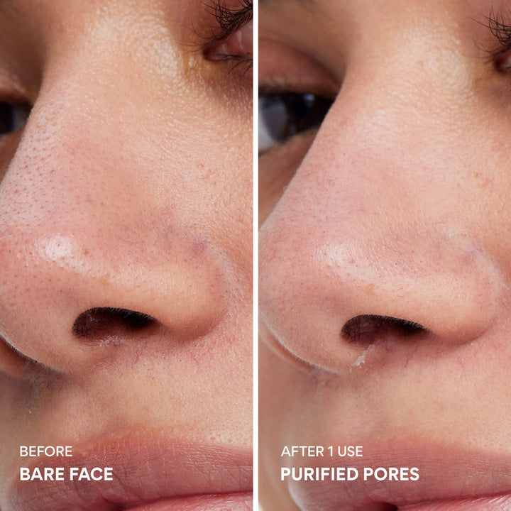 [INNISFREE] Super Volcanic Pore Clay Mask 80g — before and after